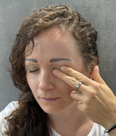 Bindehautentzündung 400